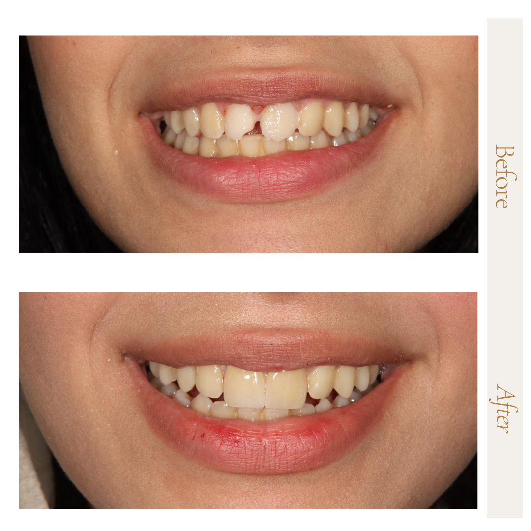 ابتسامة صحية